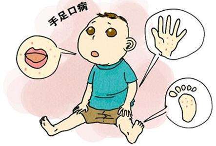 春意盎然，勿忘防治手足口